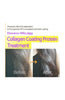 Elizavecca - Milky Piggy CER-100 Collagen Ceramide Coating Protein Treatment 100Ml - Palace Beauty Galleria
