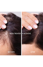 Therapispa Hair Regrowth Serum F / Herbs & Biotin 110Ml - Palace Beauty Galleria