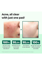 SOME BY MI AHA BHA PHA 30 DAYS Miracle Clear Pad 70ea - Palace Beauty Galleria