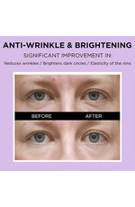 VARI:HOPE Biotics Vital Anti-Aging Eye Cream  20Ml - Palace Beauty Galleria