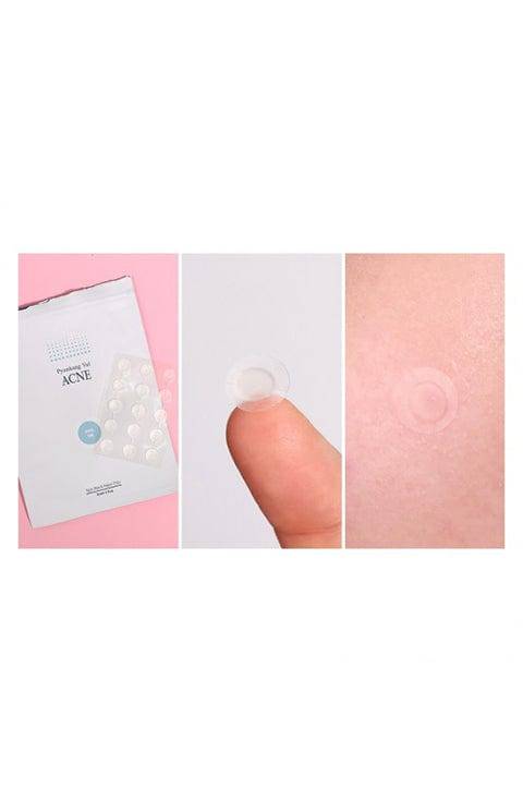 PYUNKANG YUL ACNE Spot Patches Super Thin 10mm x 15Ea - Palace Beauty Galleria