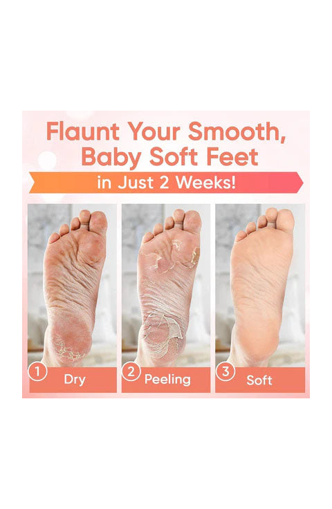 Baby Foot - Original Foot Peel Exfoliator For Men