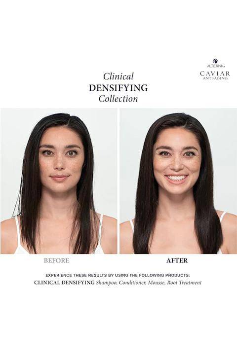 ALTERNA Caviar Anti-Aging Clinical Densifying Scalp Treatment 125Ml - Palace Beauty Galleria